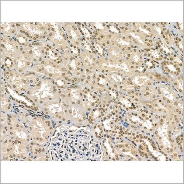 product-image-AAA31172_IHC6.jpg