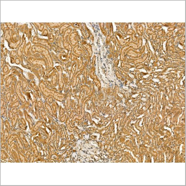 product-image-AAA31173_IHC2.jpg