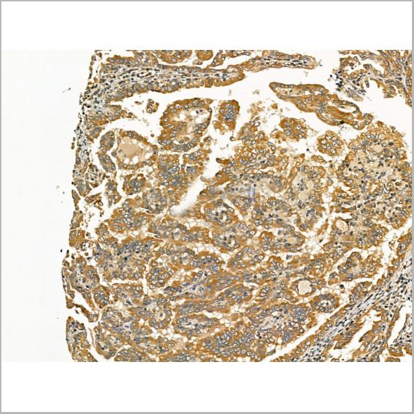product-image-AAA31173_IHC6.jpg