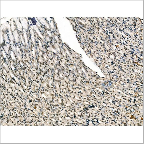 product-image-AAA31174_IHC2.jpg