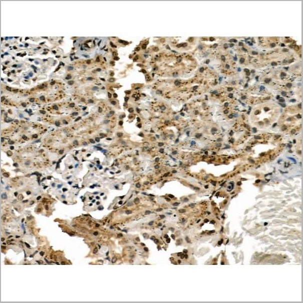 product-image-AAA31174_IHC4.jpg