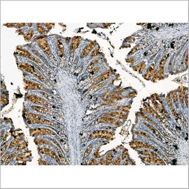 product-image-AAA31175_IHC2.jpg