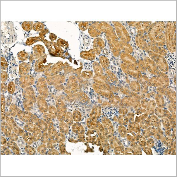product-image-AAA31175_IHC5.jpg