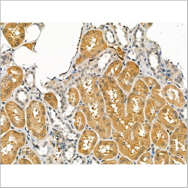 product-image-AAA31175_IHC6.jpg
