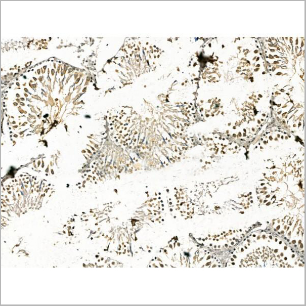 product-image-AAA31176_IHC2.jpg