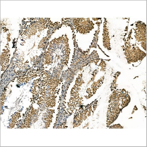 product-image-AAA31176_IHC3.jpg