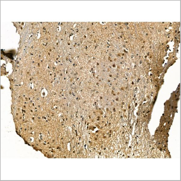 product-image-AAA31176_IHC4.jpg