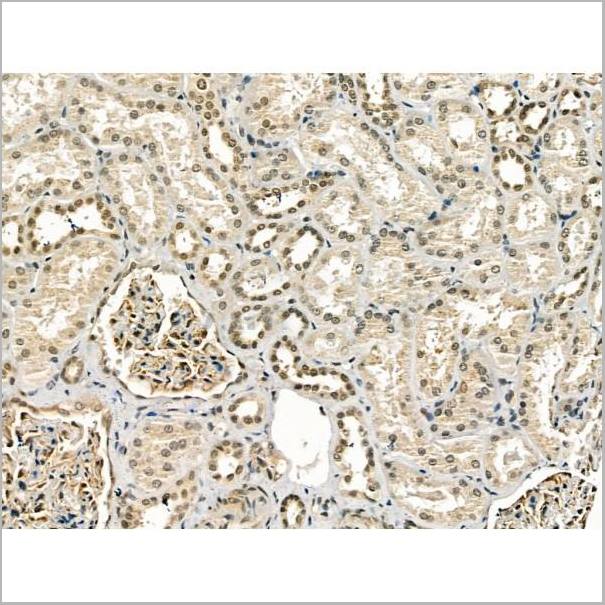 product-image-AAA31176_IHC5.jpg