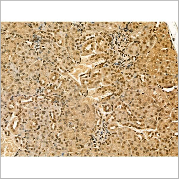 product-image-AAA31177_IHC4.jpg