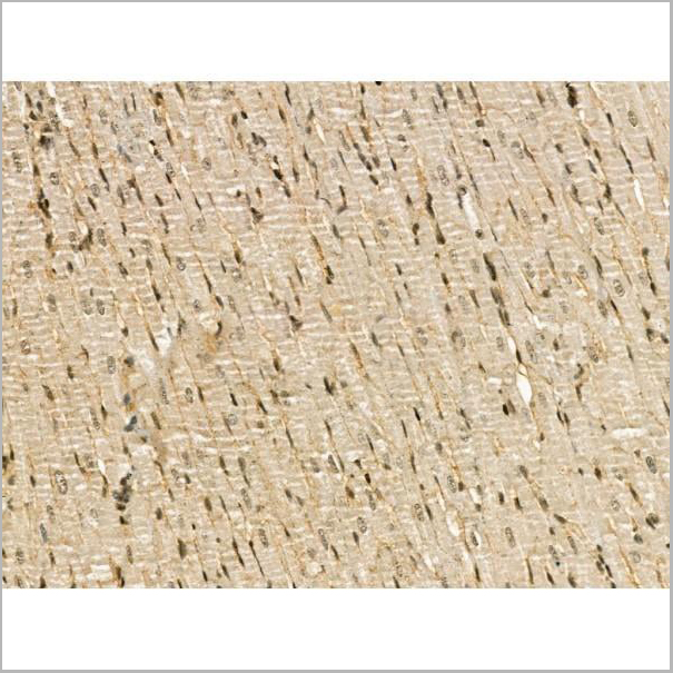product-image-AAA31178_IHC2.jpg