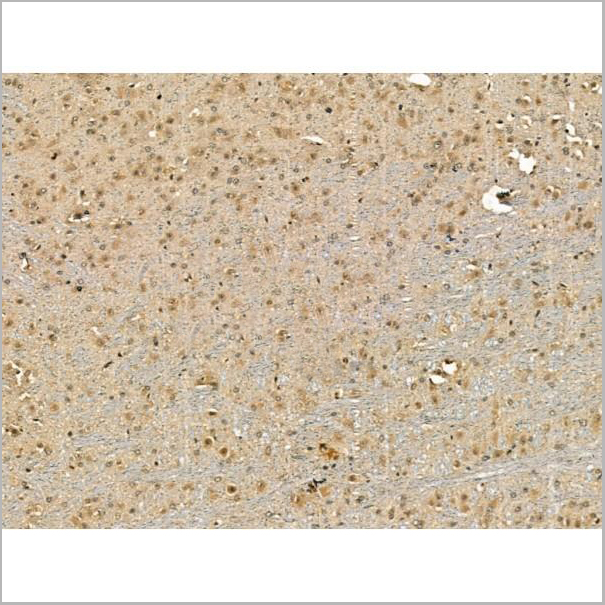 product-image-AAA31178_IHC3.jpg