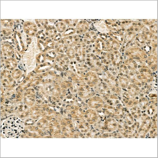product-image-AAA31178_IHC4.jpg