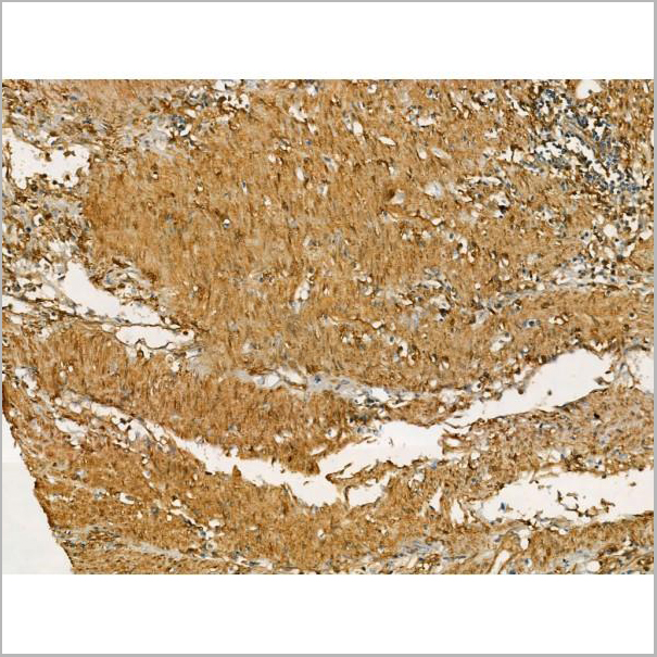product-image-AAA31179_IHC3.jpg