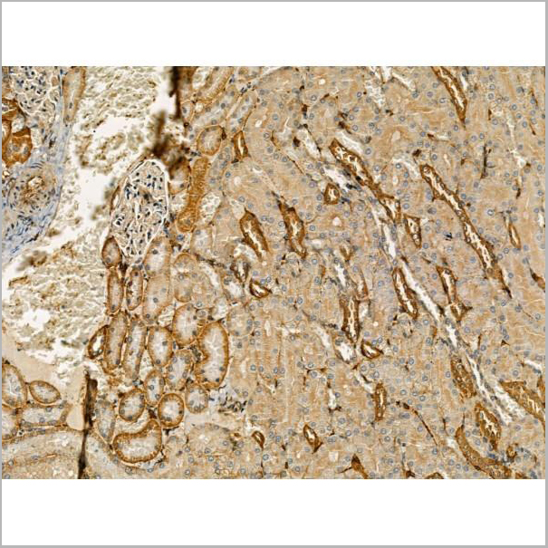 product-image-AAA31179_IHC5.jpg