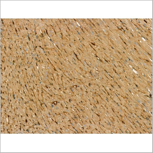 product-image-AAA31179_IHC6.jpg
