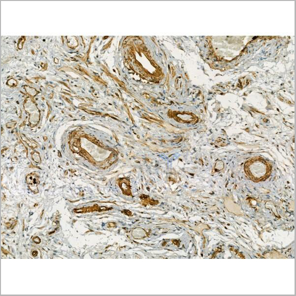 product-image-AAA31179_IHC7.jpg