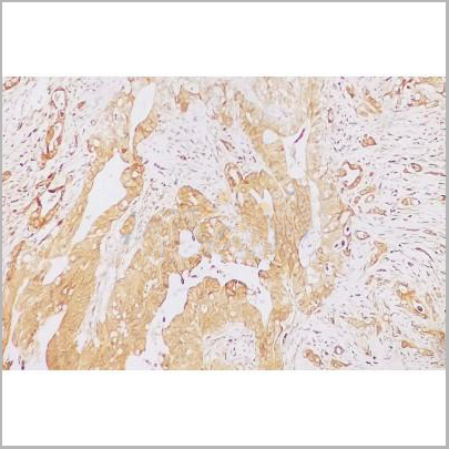 product-image-AAA31179_IHC8.jpg