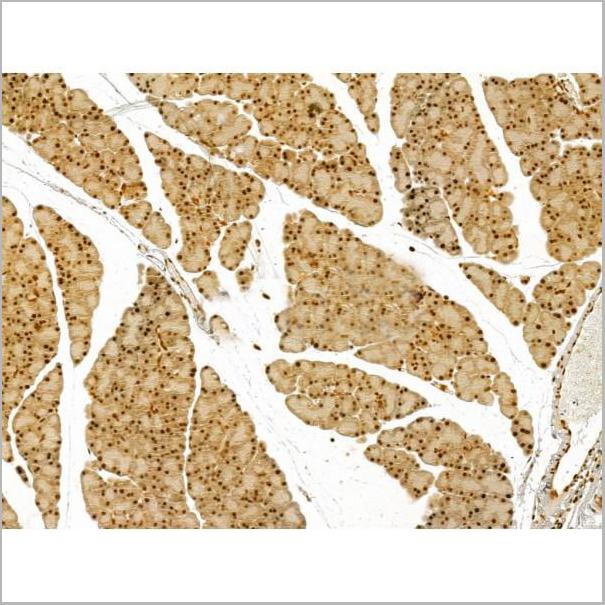product-image-AAA31180_IHC2.jpg