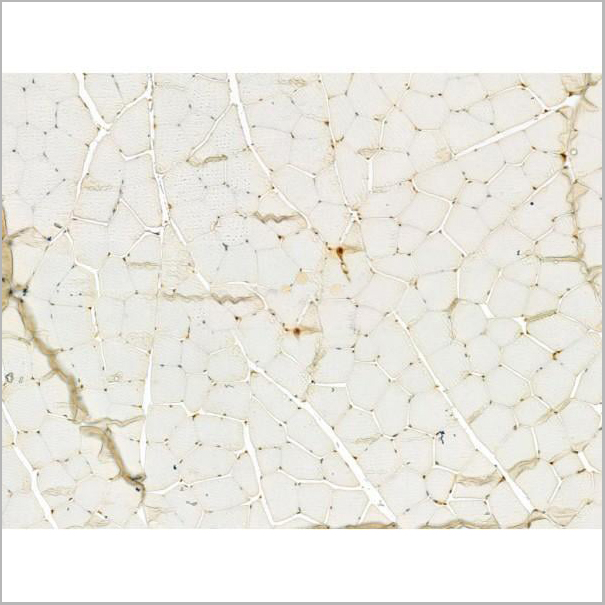 product-image-AAA31180_IHC3.jpg