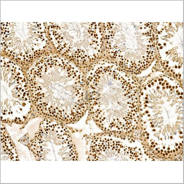 product-image-AAA31180_IHC4.jpg