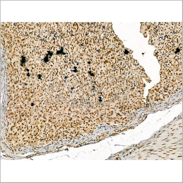 product-image-AAA31180_IHC6.jpg