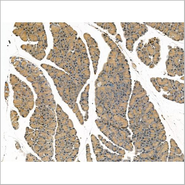 product-image-AAA31181_IHC2.jpg