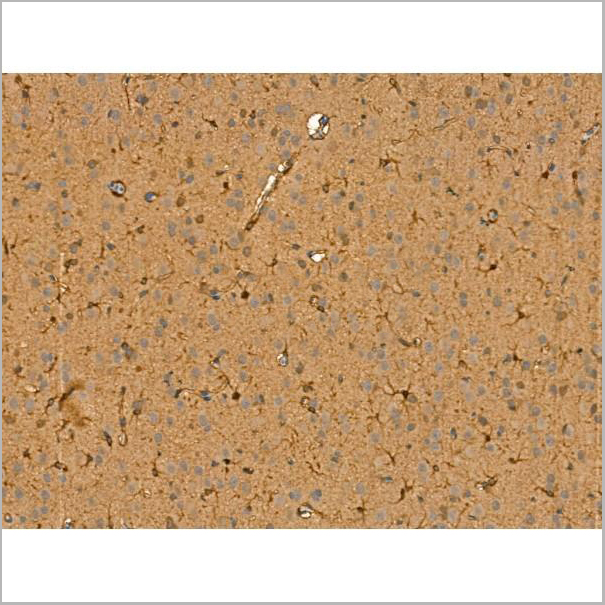 product-image-AAA31181_IHC3.jpg