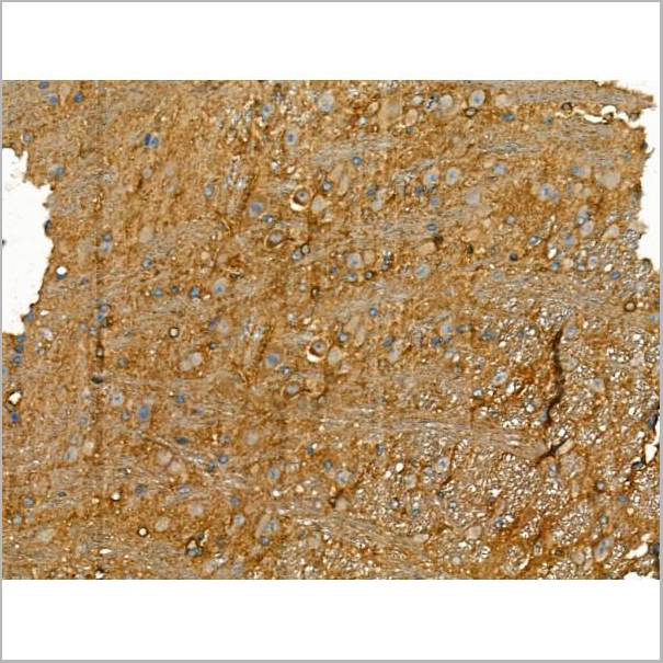 product-image-AAA31181_IHC4.jpg