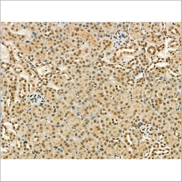 product-image-AAA31182_IHC10.jpg