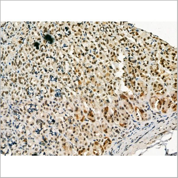 product-image-AAA31182_IHC2.jpg