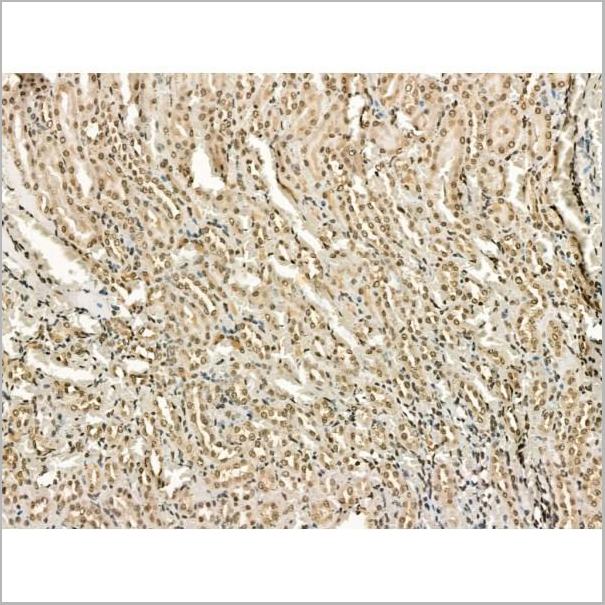 product-image-AAA31182_IHC3.jpg