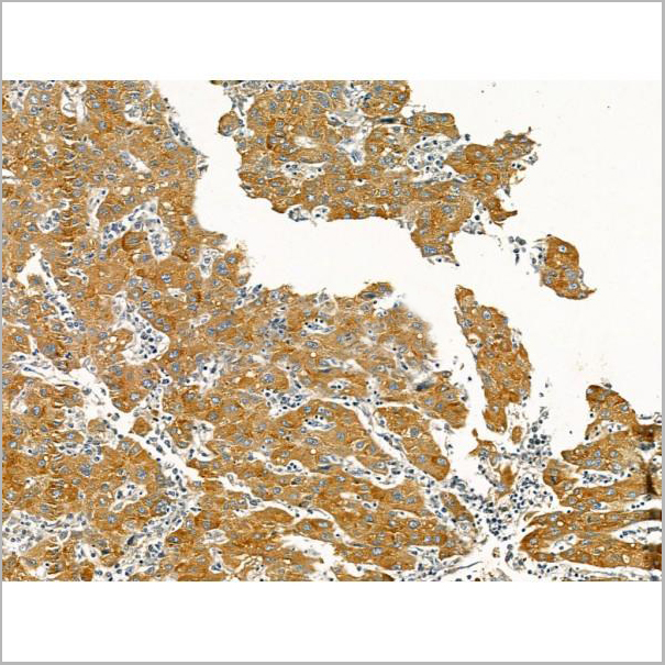 product-image-AAA31183_IHC2.jpg