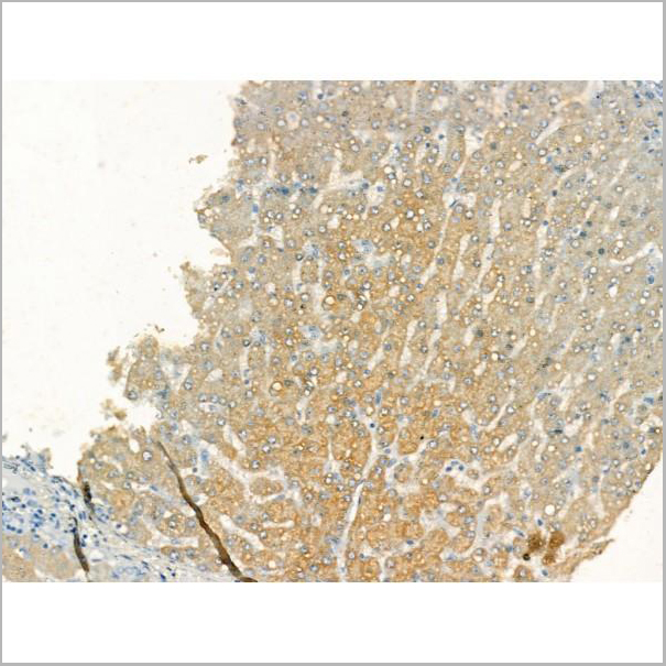 product-image-AAA31183_IHC3.jpg
