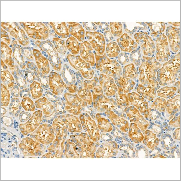 product-image-AAA31184_IHC10.jpg