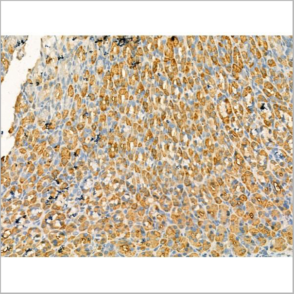 product-image-AAA31184_IHC2.jpg