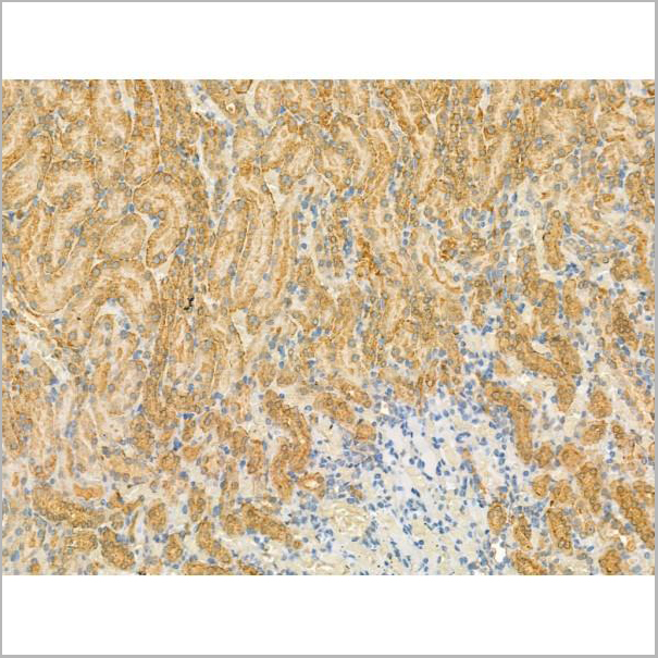 product-image-AAA31184_IHC3.jpg
