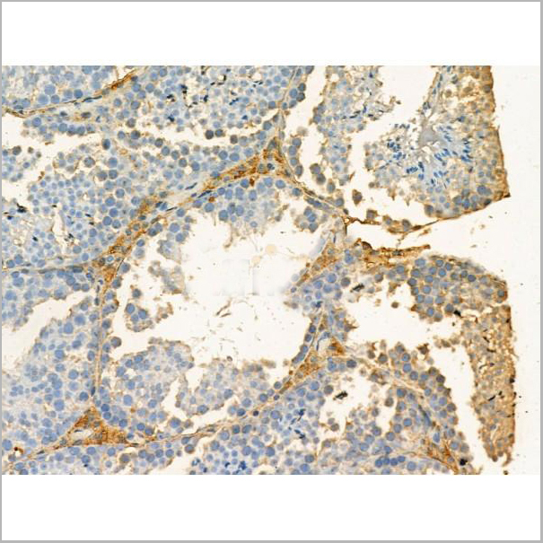 product-image-AAA31184_IHC5.jpg