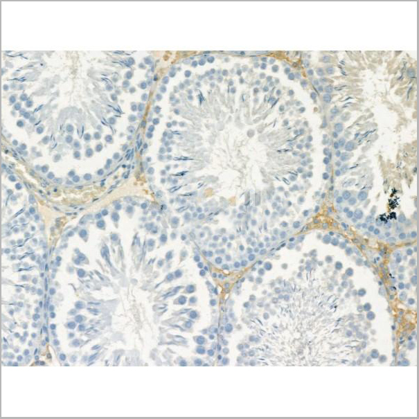 product-image-AAA31185_IHC3.jpg