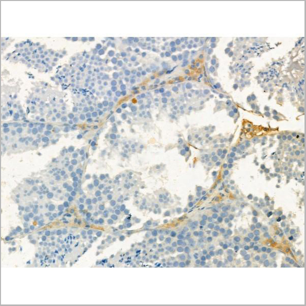product-image-AAA31185_IHC4.jpg