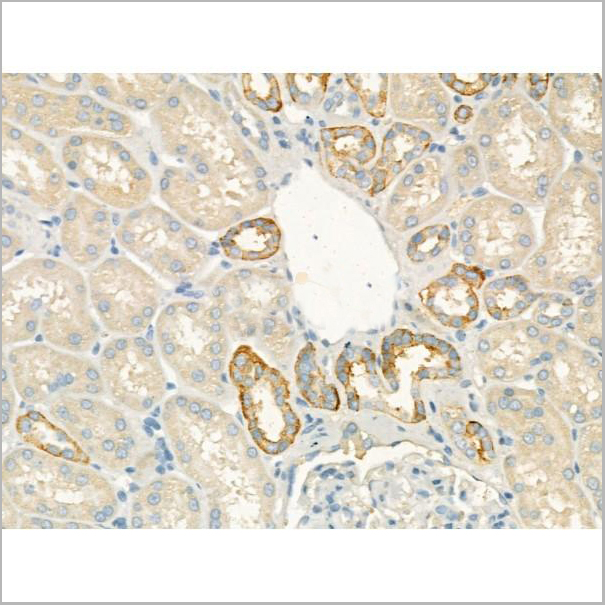 product-image-AAA31185_IHC5.jpg