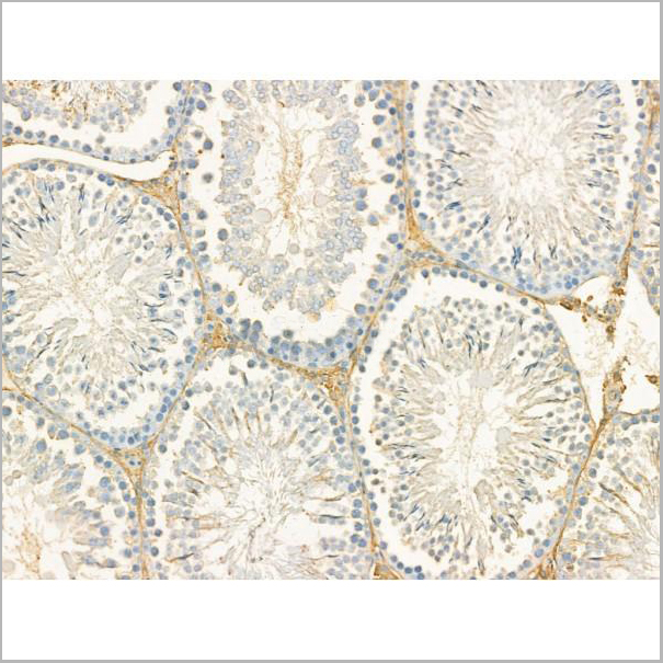 product-image-AAA31186_IHC2.jpg