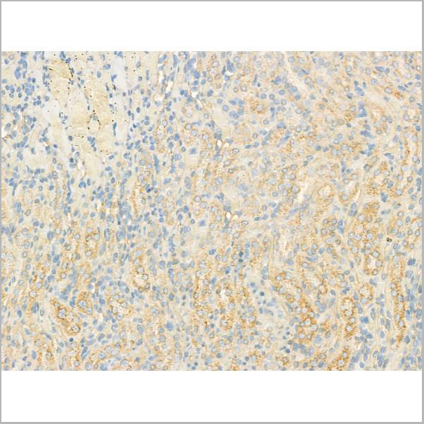 product-image-AAA31186_IHC4.jpg