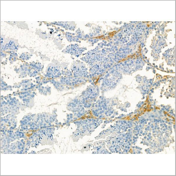product-image-AAA31186_IHC7.jpg
