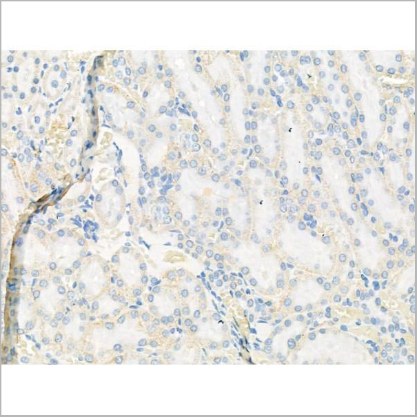 product-image-AAA31187_IHC2.jpg