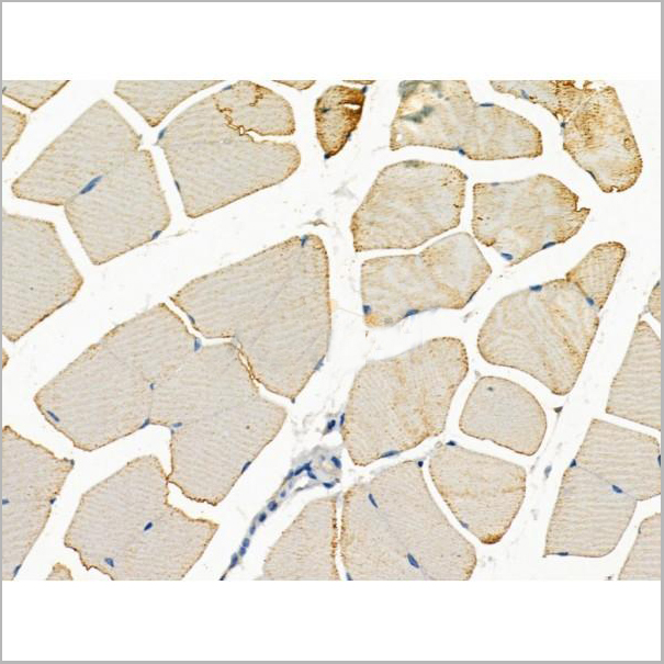 product-image-AAA31187_IHC4.jpg