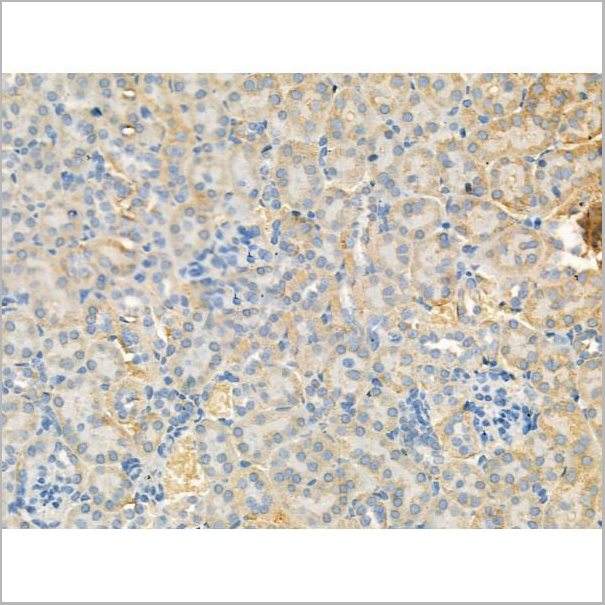 product-image-AAA31187_IHC5.jpg