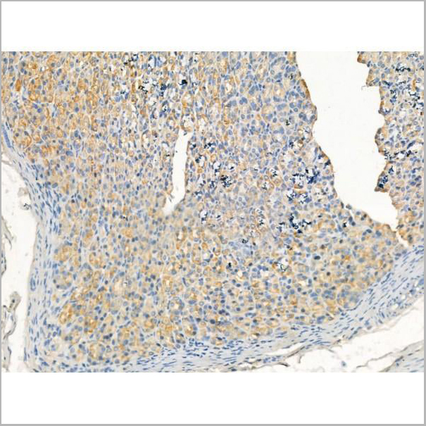 product-image-AAA31188_IHC2.jpg