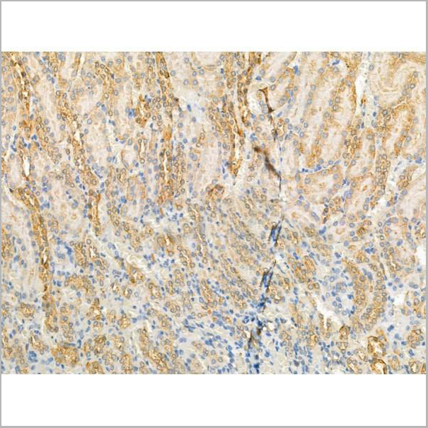 product-image-AAA31188_IHC3.jpg