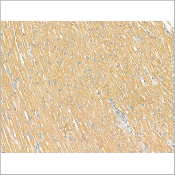 product-image-AAA31188_IHC5.jpg