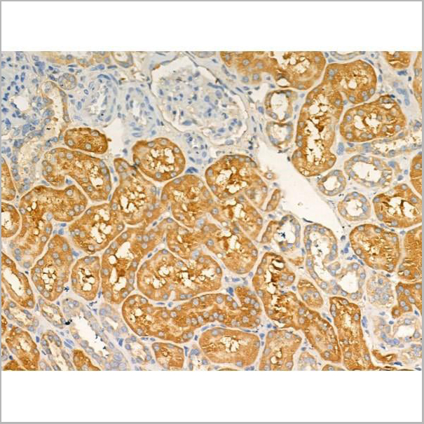 product-image-AAA31188_IHC6.jpg